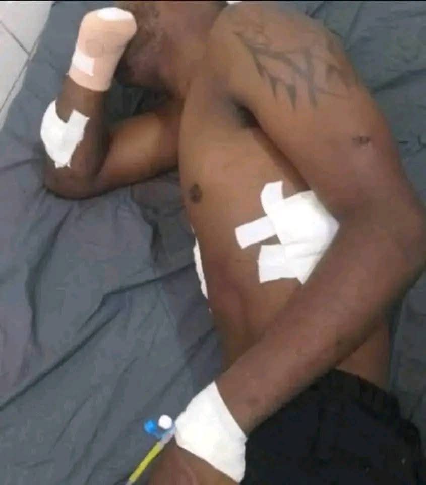 Congo: de retour d&rsquo;une soirée festive, un jeune homme se retrouve avec plusieurs parties de son corps coupées