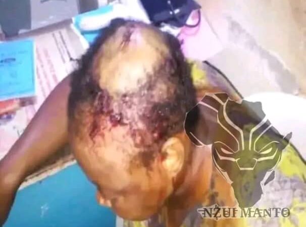 JIF 2025: un 08 mars noir pour une comédienne, son mari lui a ouvert le crâne pour une simple causerie 