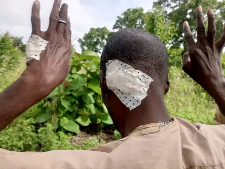 Sinendé : une nouvelle attaque à domicile, un éleveur et sa femme tabassés