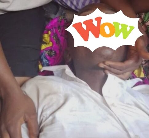 Bénin : Un homme succombe après une relation sexuelle avec une femme mariée dans un hôtel