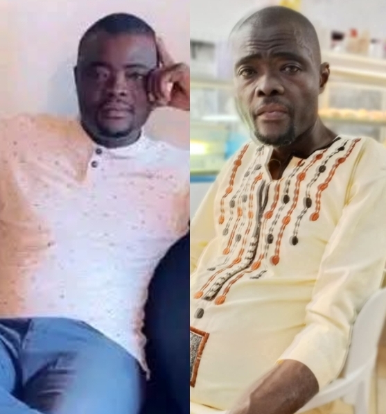 Regards croisés : Judicaël Gbaguidi, martyr de l&rsquo;insuffisance rénale