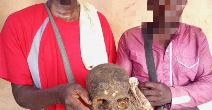 Abomey-Calavi : deux individus arrêtés après la découverte d&rsquo;un crâne humain dans un tricycle