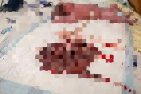 Cotonou: un nouveau-né retrouvé abandonné avec le placenta dans les herbes à Kindonou